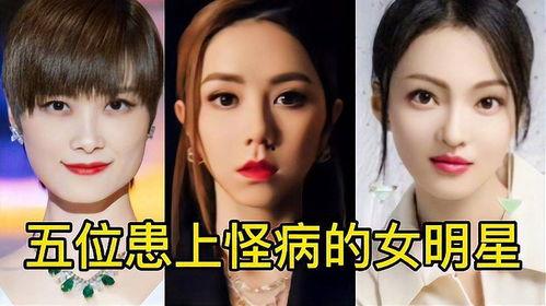 女明星的怪病,女明星病情揭秘